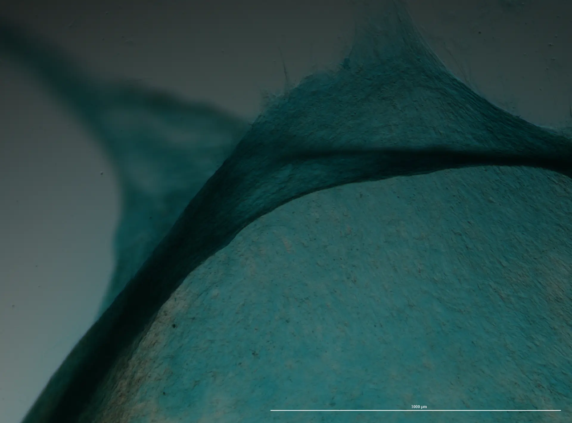 Mesenchymal stem cells in culture